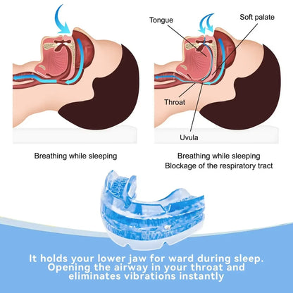 Silentra™ | Anti-Snoring Device