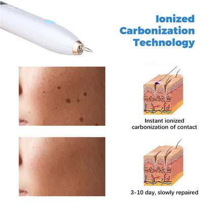 Skinova™ | Skin Tag Remover