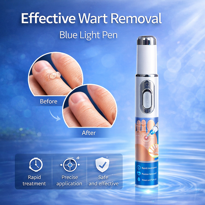 Skinova™ | Wart Laser Remover