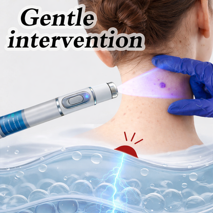 Skinova™ | Wart Laser Remover